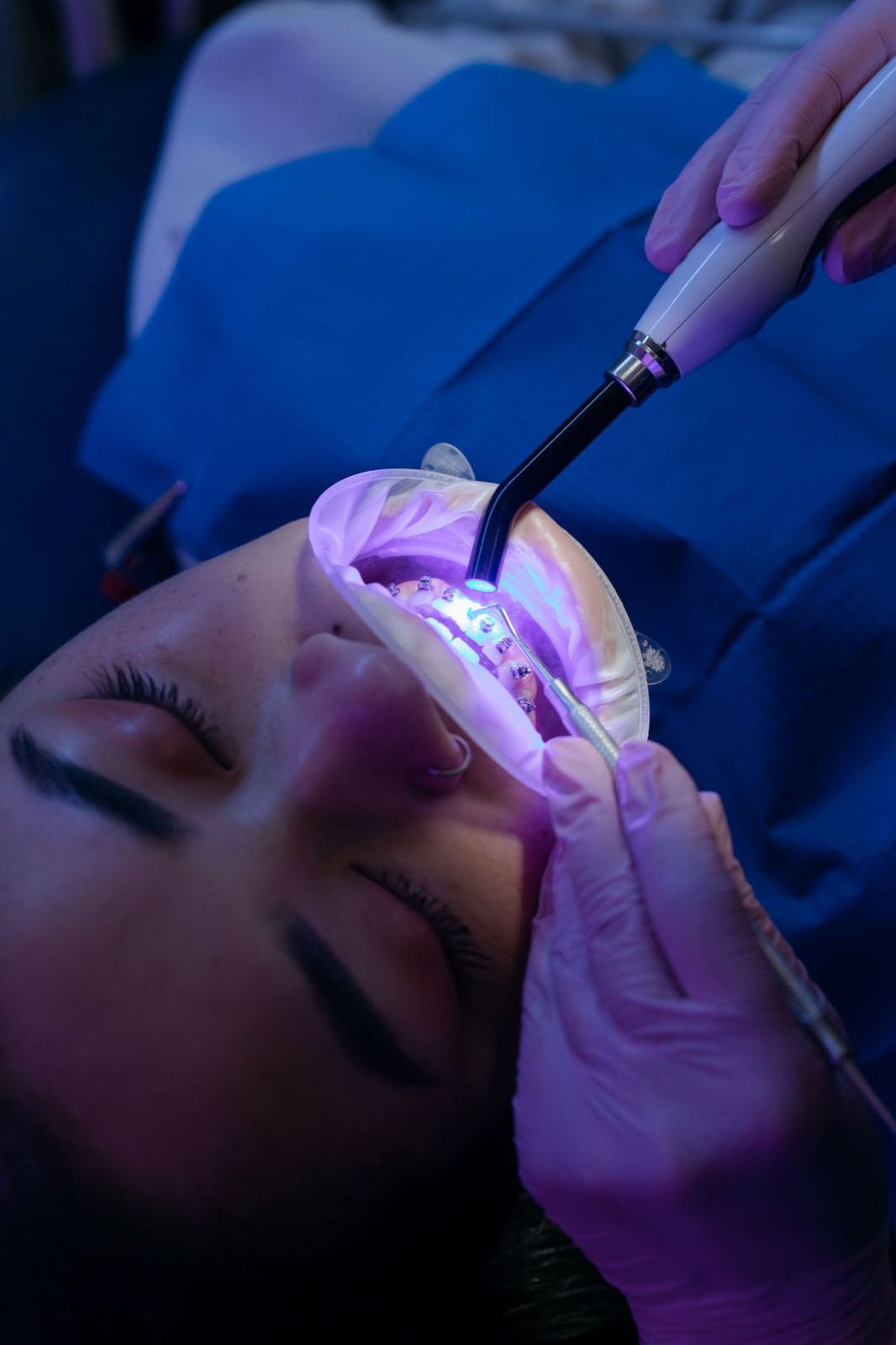 Same Day Smile treatment at TJ Smile Studio, Glasgow