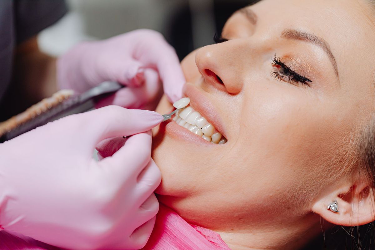 Veneers treatment at TJ Smile Studio, Glasgow